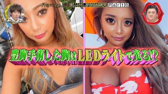 [With image] Super small breasts, reborn with breast augmentation surgery wwwww 3th image