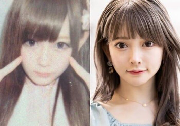 [Regret] plastic surgery girl 'I should have had plastic surgery, I have a beautiful and perfect face, but it's hard for me to have an artificial face' 4th image
