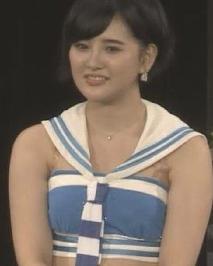 Former HKT48 ace Haruka Kodama (27) has been undergoing cosmetic surgery since her teens and has a total face of over 10 million www 3th image